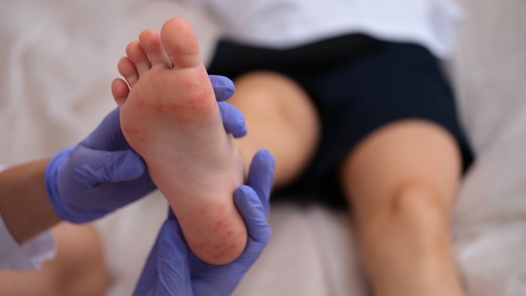 Problemas comunes de los pies y cómo tratarlos