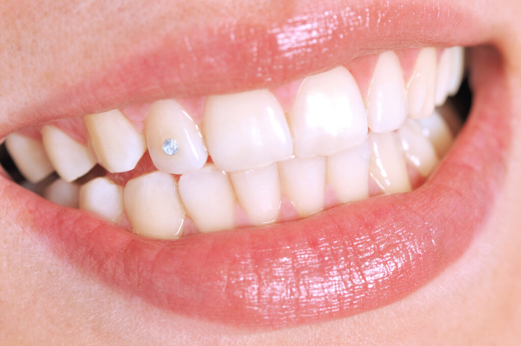 modas salud bucodental