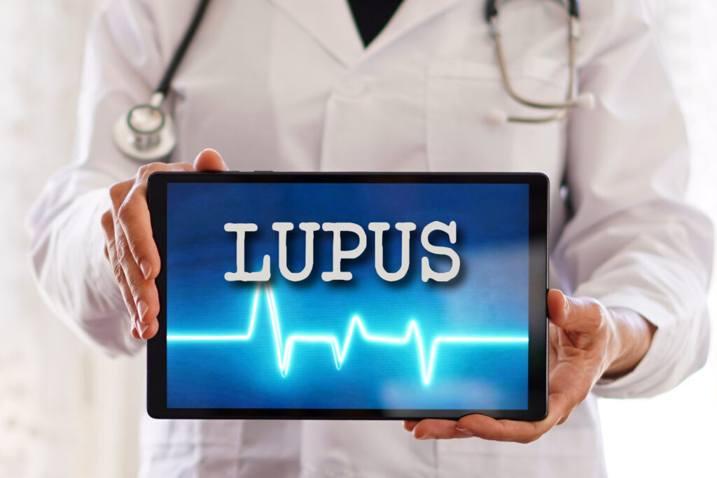 Lupus eritematoso sistémico