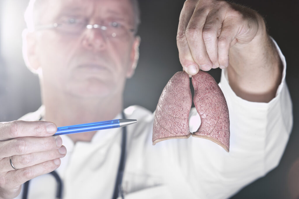 detección precoz del cáncer de pulmón
